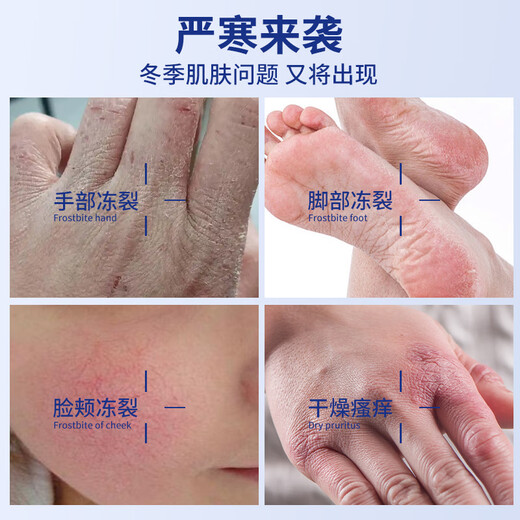 Xinxile cracking 85g Vaseline hand cream to prevent dry cracking of hands, feet and heels, non-medical genuine anti-cracking cream