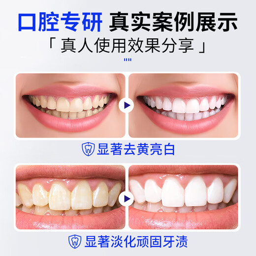 KALZELUN卡泽伦小苏打牙膏卡择仑男女臻白护龈口腔护理清新口气洁白咔择伦 亮白薄荷香型 120g*3支 【立省39】