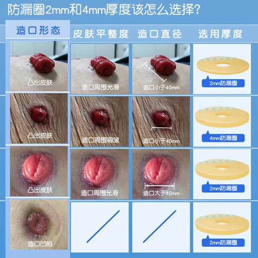 Nurse classmate stoma leakage protection ring 12035 same plastic patch ring chassis leakage protection seal elastic glue stoma care products 12030 [10 pieces/box] 2mm stoma leakage protection ring