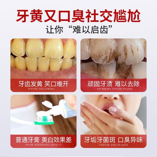 MUESRGTEI胖东美白牙膏来抑菌除口臭去黄牙渍烟渍牙垢十大知名品牌含氟护龈 一盒装【去黄去渍】