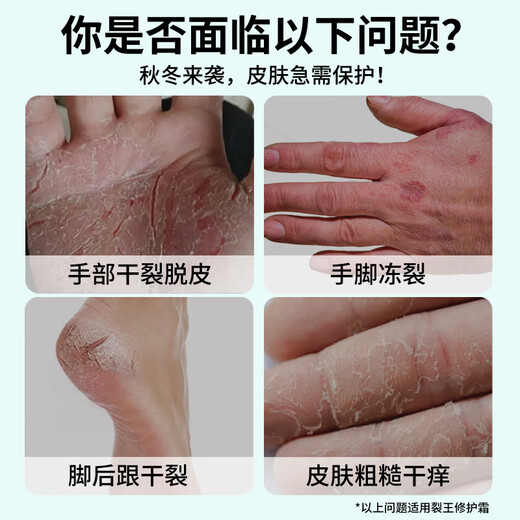 New Xile Cracking King 88g Cracking Ning Vaseline Anti-Cracked Hand Cream Heel Non-Frostbite Hands and Feet Freeze-Cracked Cream