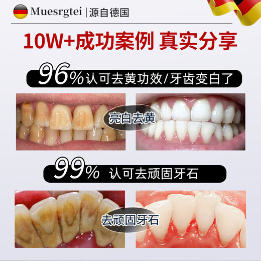 MUESRGTEI胖东美白牙膏来抑菌除口臭去黄牙渍烟渍牙垢十大知名品牌含氟护龈 一盒装【去黄去渍】