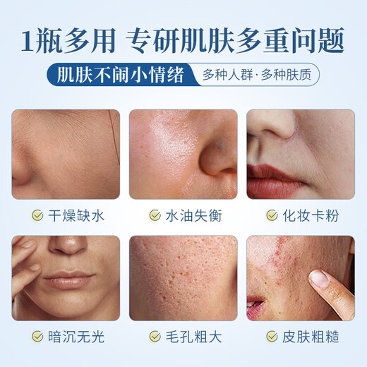 Zikele Vitamin e Hautpflege Glycerin Verjüngung feuchtigkeitsspendende Essenz mit Feuchtigkeitsfeuchtigkeitsfeuchtigkeitsfeuchtigkeitsmake -up ohne Pulver, bevor feuchtigkeitsspendende 2 Flaschen erfrischt werden