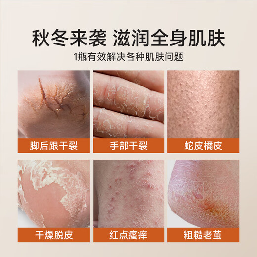 Dr. Watson's horse oil ointment hand cream and cracked feet ointment for dry and cracked heels, whitening and moisturizing for hands and feet, anti-dry and rough winter