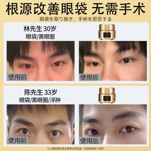 焦博士日本眼霜去眼袋消除重度眼袋专用黑眼圈重度去除女男士中老年神器