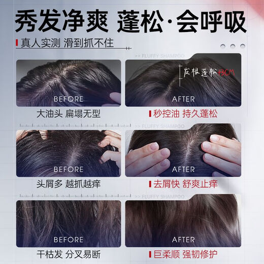 Contrôle de l'huile de grain coréen shampooing pelucy silicone sans huile anti-phase Anti-icminy acide aminé acide n ° 1 dans la liste d'or des hommes et des femmes