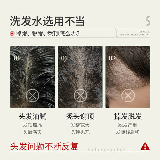 SKISGEM German imported anti-hair loss ginger high-end shampoo anti-itch, anti-dandruff, oil-control, fluffy shampoo cream for men and women, second stage, strong hair roots, anti-hair loss shampoo*2