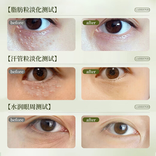 珂大生物脂肪粒眼部精华液颗粒清肌油脂粒黑眼圈眼袋眼补水保湿嫩肤凝胶霜 两盒装
