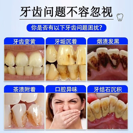 Wishine Thailand imported tooth washing powder, smelly, yellow removed tooth stains, smoke stains, littering white, fresh cleaning powder 80g