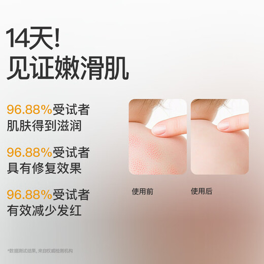 Sakose Vaseline Children's Calendula Body Lotion 500ml*2 Autumn and Winter Baby Moisturizing Lotion Moisturizing and Moisturizing Dry Skin