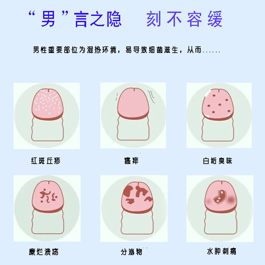 HEBST Japanese Posthitis Balanitis Ointment Fungal Infection Pearly Rash Scrotum Moist Itching Special Effective Spray