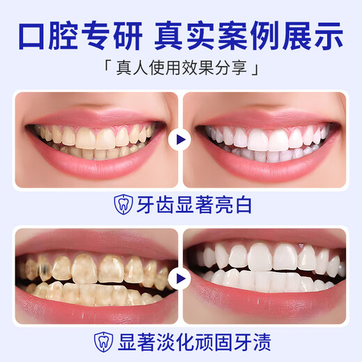 Jiafuni Pasta de dientes Limpieza de dientes blanqueamiento diente de diente fresco Hombres y mujeres Jiafuni Pasta de dientes más insignia fresca Tres paquetes*360G