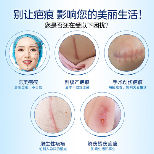 Changyinuo medical silicone scar patch, special scar hyperplasia, raised pimple repair patch for burns and scalds after caesarean section, one box, trial pack, mild scars, 5*50cm/1 roll/box