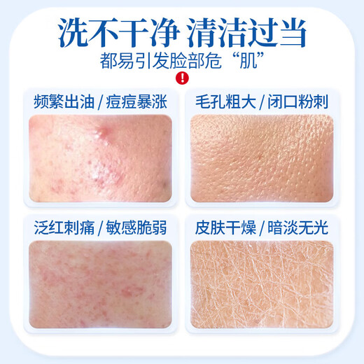 Renhe Ingenious Facial Cleanser, Sophora Sophora, Amino Acid Moisturizing Oil Control, Men's and Women's Facial Cleanser, Goddess' Day Gift