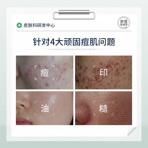Naixi Japanese salicylic acid mask removes acne marks and controls oil removal acne shrinkage pores fading eliminates women men repair teenagers