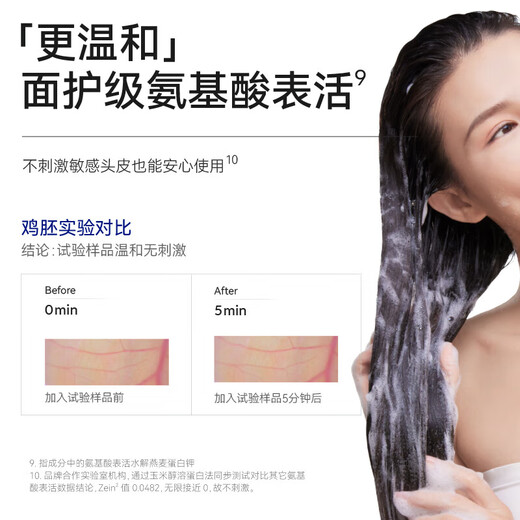 Manting (mantenimiento) Aminoácido Tensioactivo Campoo anti-moderno controlado por aceite 450 ml (Sham para hombres y mujeres refrescantes y limpios)