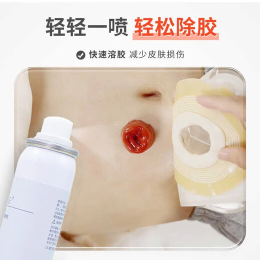 康宝乐造口黏胶去除剂12010造口袋护理医用造瘘口底盘剥离剂平替康乐保 K12010造口黏胶剥离剂 50ml/瓶