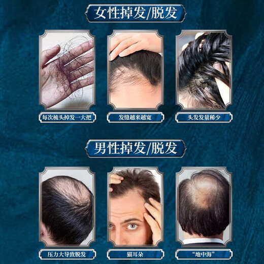 
Nanjing Tongrentang Ginger Prevention and Developing Shampoo for Hair Resilience and Long Hair Loss and Oil Control Herbal Shampoo for Men and Women 400ml 1 Bottle 400ml [Minor Hair Loss]
