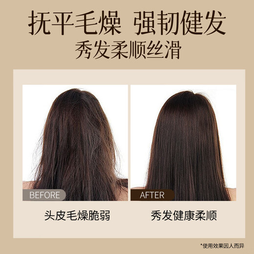 Brightening anti-dandruff anti-hair shampoo 500g plant scalp care shampoo hair strength and reduce hair breakage shampoo