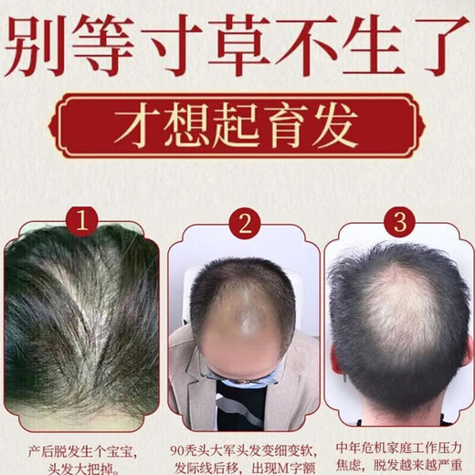
Nanjing Tongrentang Ginger Prevention and Developing Shampoo for Hair Resilience and Long Hair Loss and Oil Control Herbal Shampoo for Men and Women 400ml 1 Bottle 400ml [Minor Hair Loss]