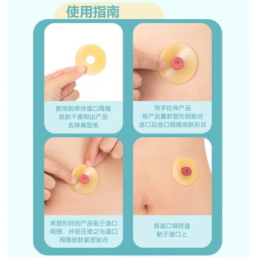 
Leak-proof patch ring 12042 shaping port leakage-proof ring 12030 fistula chassis protection 1 box/10 M12030 leak-proof patch ring (2mm thick)