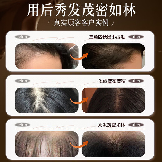 HIEUAILR生姜防脱育发洗发水控油蓬松去屑密发固发养发增发长发男女士脱发
