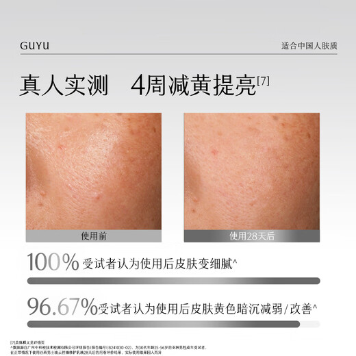 Guyu [same as Wang Anyu] Men's Cleansing Milk Set Gift Box, Oil Control, Acne Removal, Hydrating and Moisturizing for Boys