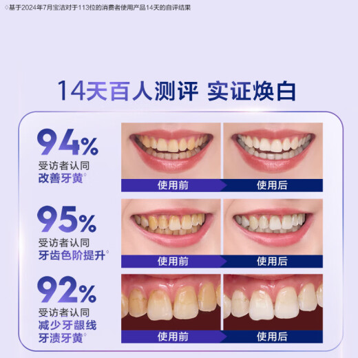 佳洁士焕齿白热感美白牙膏清口气去烟渍去黄去渍CP款180g京东自营