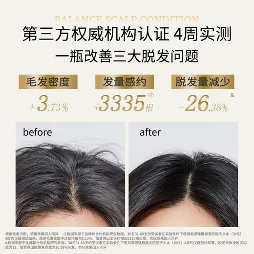 Ziyuan Anti-detachment Strong and Tough Oil Control Shampoo 1055ml Ginger Hair Solid Set Orchidaceae Shampoo Silicone Oil-free Shampoo