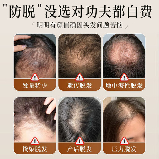 HIEUAILR生姜防脱育发洗发水控油蓬松去屑密发固发养发增发长发男女士脱发