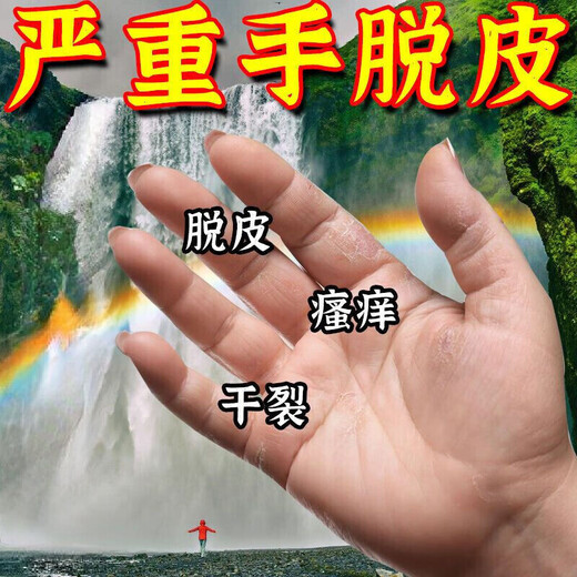 Yunnan Materia Medica Hand and Foot Peeling Antibacterial Cream Seasonal Hand Peeling Finger Palms Sloughing, Cracking, Cracking, Skin Blistering Fungal Infection Hand and Foot Peeling Cream 20g One bottle sent 1 bottle/box
