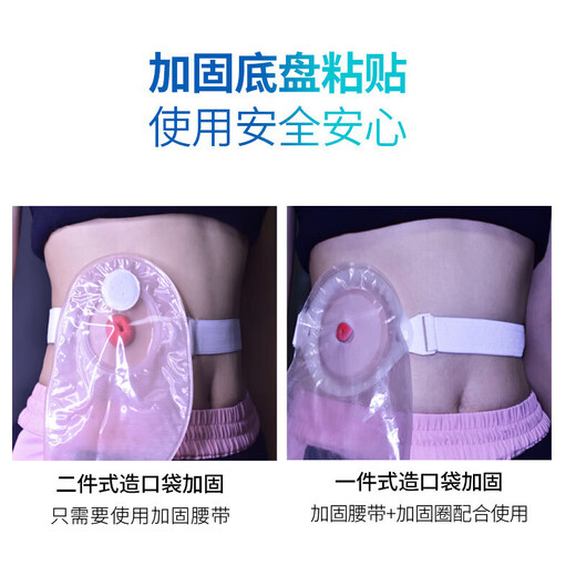 念顷（念顷爱 汇成海）造口加固腰带地盘尿路肛肠通用造口弹力加固带造瘘袋护理附件念顷 9207/二件式造口腰带/腰带/1条