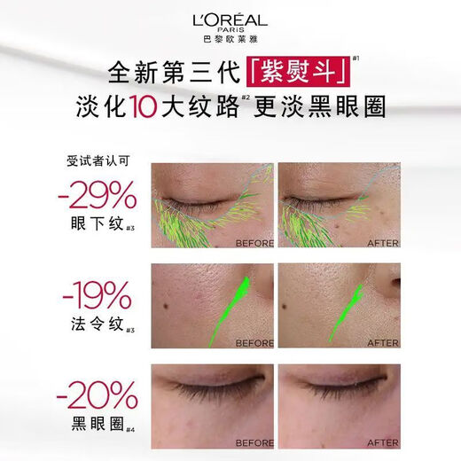 欧莱雅 L'OREAL第三代紫熨斗眼霜玻色因全脸保湿提拉紧致抗皱咖啡因淡化细纹眼霜 【到手16.5ml】紫熨斗眼霜 .