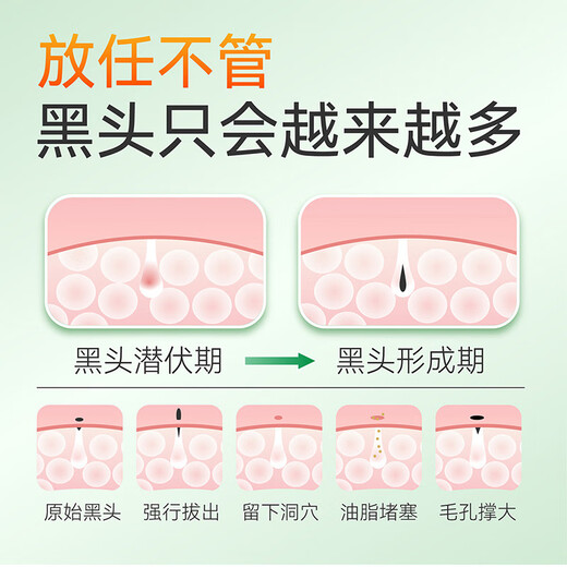 Dr. Li Blackhead Cleansing Mud Mask Binchotan Charcoal Peel-off Mask Deep Cleansing Pores and Acne Men and Women Nasal Mask 150g
