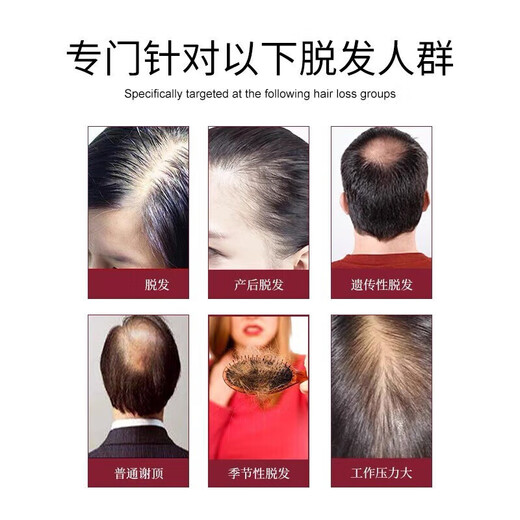 
Nanjing Tongrentang Ginger Prevention and Developing Shampoo for Hair Resilience and Long Hair Loss and Oil Control Herbal Shampoo for Men and Women 400ml 1 Bottle 400ml [Minor Hair Loss]