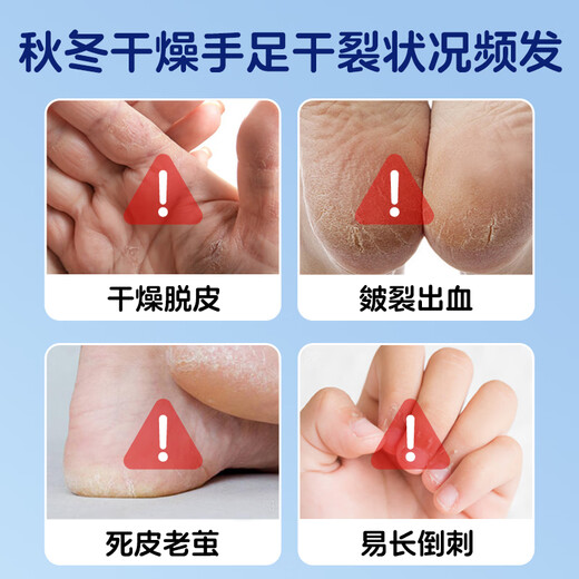 Haishi Hainuo Vaseline dry crack patch (74*24mm) 100 pieces waterproof finger tape for dry cracked hands and feet, breathable finger protection and wear-resistant