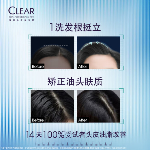 清扬（CLEAR）头皮学专研油脂调控洗发露300g 绿C瓶 控油蓬松洗发水 罗云熙同款