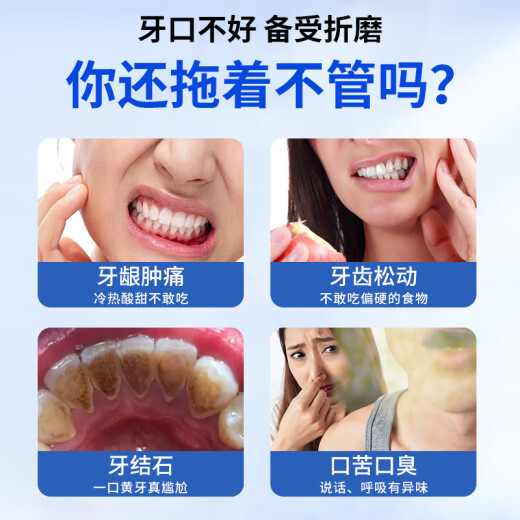 时珍世家金系列李时珍牙科分离剂牙齿松动牙龈萎缩牙周炎专用牙膏旗舰正品官方店 五盒装【巩固装】