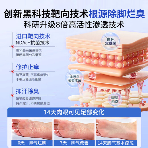 Qingzitang Athlete Spray Anti-Itchy, Peeling Rotten Foot Fungal Infection Removes Blister Foot Sweat and Feet Odor Special Spray 35ML