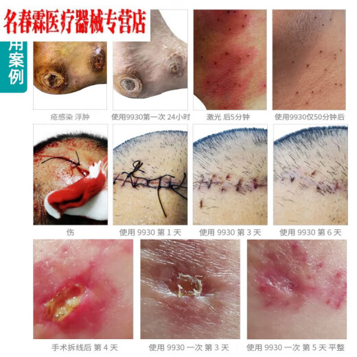 9930 Desinfectante de heridas médicas Burn Burn Surdry Trauma Surgery Hogar de desinfección no alcohólica Anti-Infección Estilo antiguo