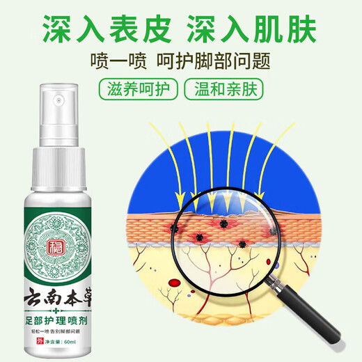 Yunnan herbal athlete's foot spray, foot odor spray 60ml*3 bottles of itchy, peeling, sweaty, foot-protecting herbal antibacterial spray