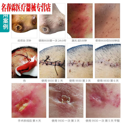 9930 Desinfectante de heridas médicas Burn Burn Surdry Trauma Surgery Hogar de desinfección no alcohólica Anti-Infección Estilo antiguo