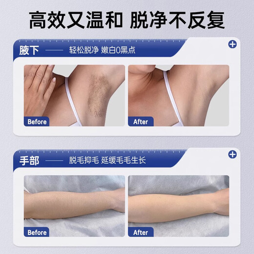 MOIHANR German high-end hair removal cream for men and women to remove beard, armpit, lip, facial, chest and leg hair from private parts, permanent root removal for the whole body, leaving no black spots and no pain, 2 sets