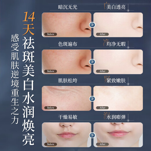 HIEUAILR德国品牌面膜美白补水淡斑提亮肤色女男士抗皱紧致抗衰老去黄提亮 【熬夜急救】3盒*45片+377精华