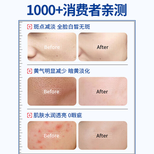 DWDS医用烟酰胺凝胶祛斑淡化黑色素色斑和熊果苷乳膏脸部用国药准字 烟酰胺凝胶3盒+熊果苷乳膏1盒【到手4盒周期装】 国药准字官方正品烟酰胺凝胶东来医用药店同款