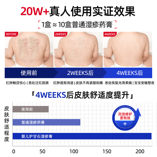 HEBST calamine baby antibacterial and antipruritic cream for eczema, heat rash, itchy skin, dermatitis, fungal infection