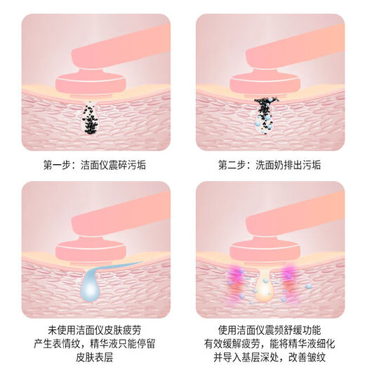 Echtes Gesichtsreinigungsinstrument, elektrische Reinigungsbürste, Porenreiniger aus Silikon, Gesichtsmassage, Schönheits- und Gesichtsreinigungsgerät für Männer und Frauen, Tiefenreinigung/Phototherapie-Hautpflege/Hochfrequenzimpuls