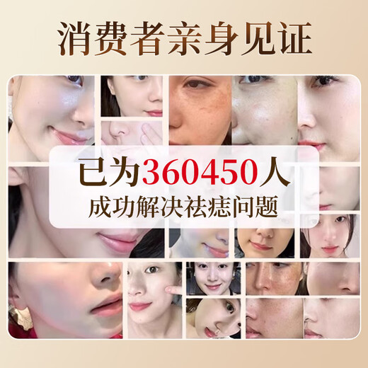 Dr. Mo's Hong Kong Pharmacy Mole Spot and Mole Removal Cream, No Scars on the Face, Black Mole Painless Repair Solution, Available for Children