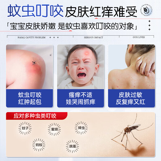 本田制药紫草膏蚊虫叮咬止痒消肿膏药婴儿儿童户外驱蚊防跳蚤解痒消包1盒