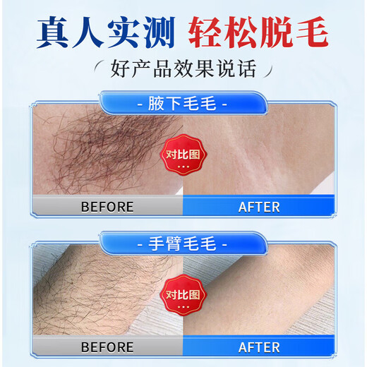 Nanjing Tongrentang Hair Removal Cream, Private Part Hair Removal Cream, Private Part Hair Removal Cream, Armpit Hair Removal Cream, Armpit Hair, Legs, Students, Men and Women, Full Body Special Artifact, Single Box, Special for Hair Removal